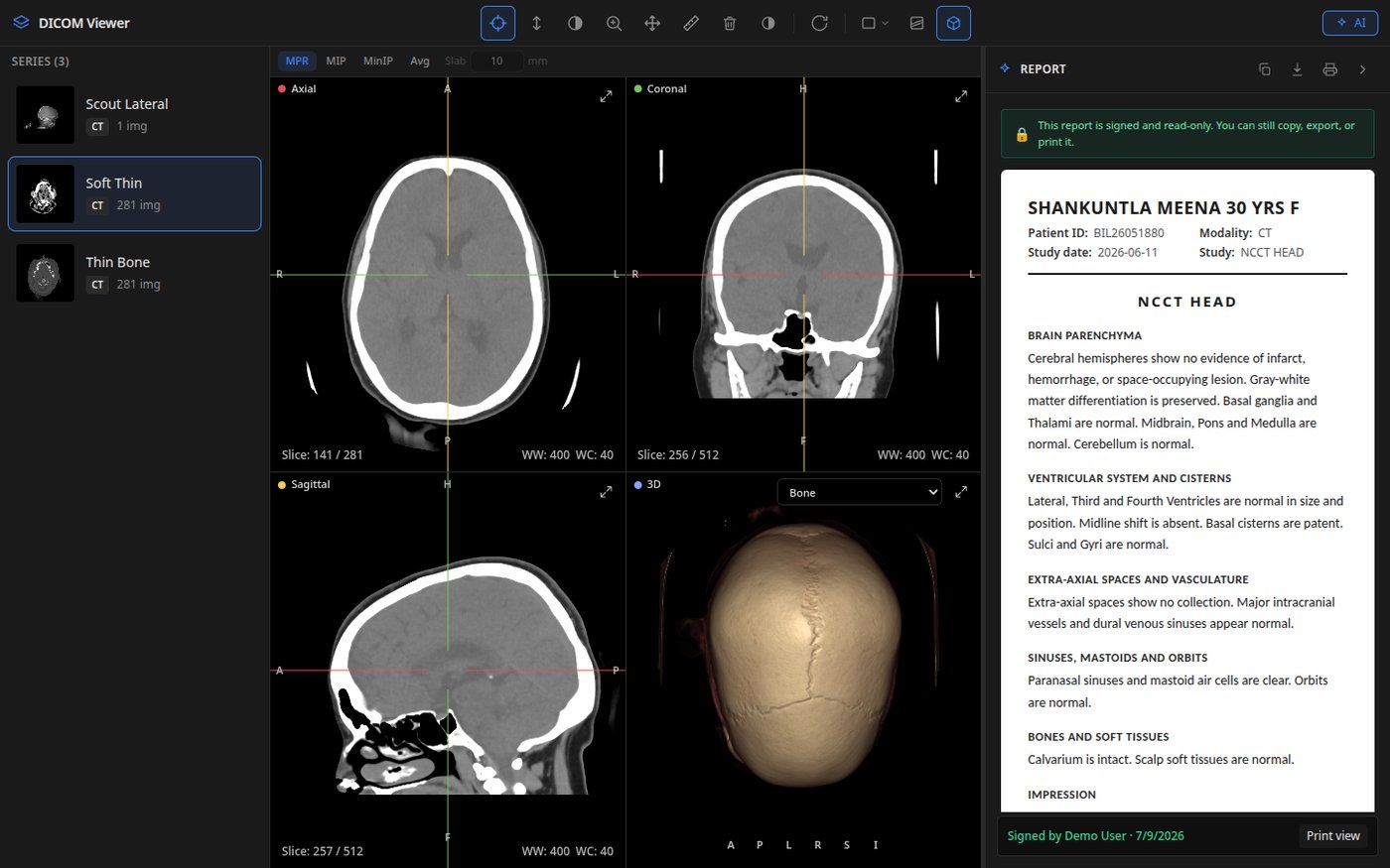 DICOM viewer 3D workspace: MPR slices and volume-rendered skull of a head CT with signed report